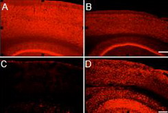 Neuronal loss imaging, LFB staining (glial myelin), Golgi staining (dendritic spine), Schiff staining, HE staining