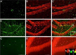 Neuronal confocal analysis, neurogenesis, neuron immuno-staining