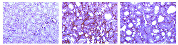 Unilateral Ureteral Obstruction (UUO) renal kidney fibrosis and tubular injury model, IHC staining 