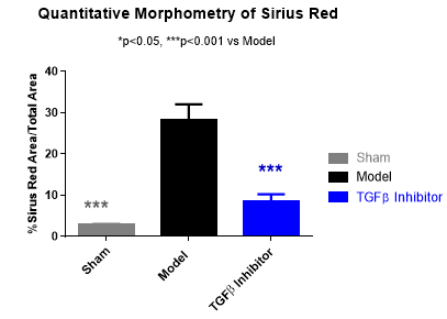 kidney fibrosis and tubular injury model, Sirius red quantitative morphometry