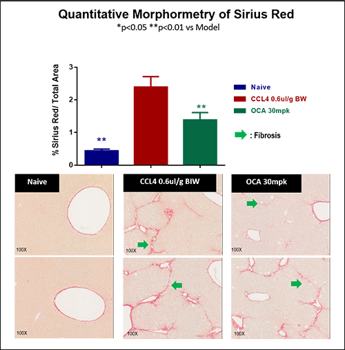 quantitative morphormetry of sirius red, to assess liver fibrosis in mice via CCl4