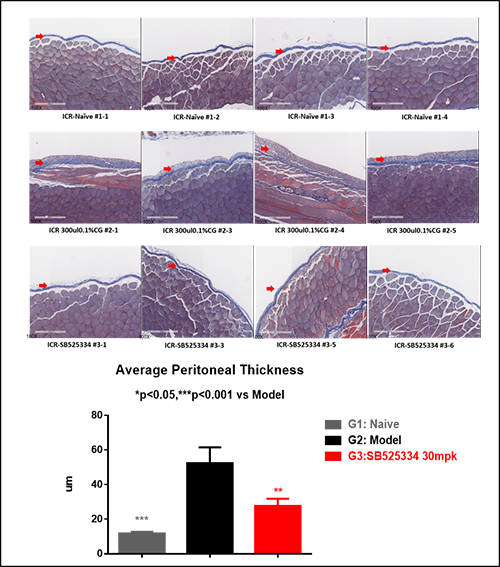 Peritoneal fibrosis model induced by chlorhexidine gluconate in mice 