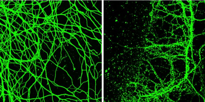 neurons, neuronal cells, in vitro cell culture, immunofluorescence