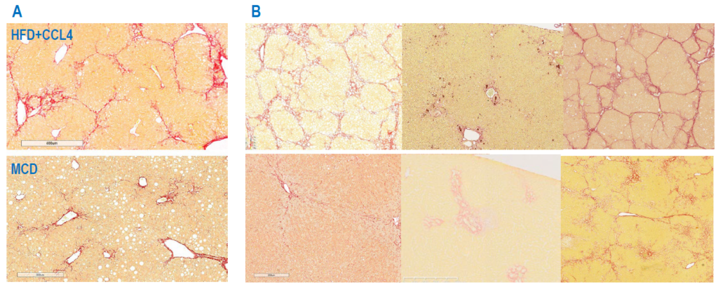 Hepatic fibrosis in rodent models