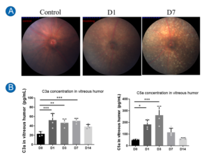 eye disease blog figure 4