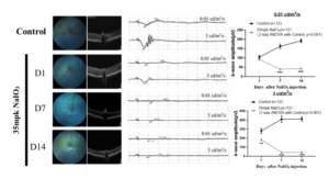 eye disease blog figure 5