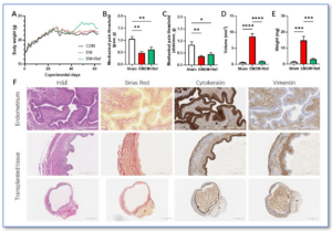 figure 2 blog endometriosis